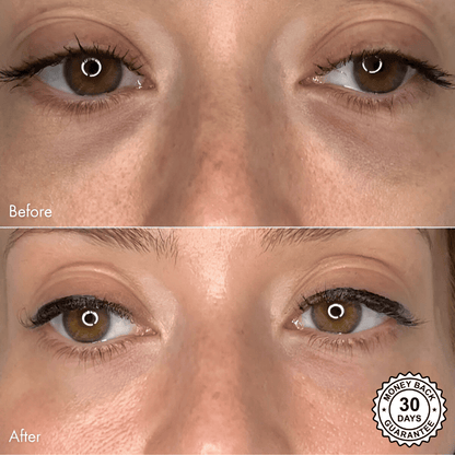 HydraLift™ - Eye Glow Patches